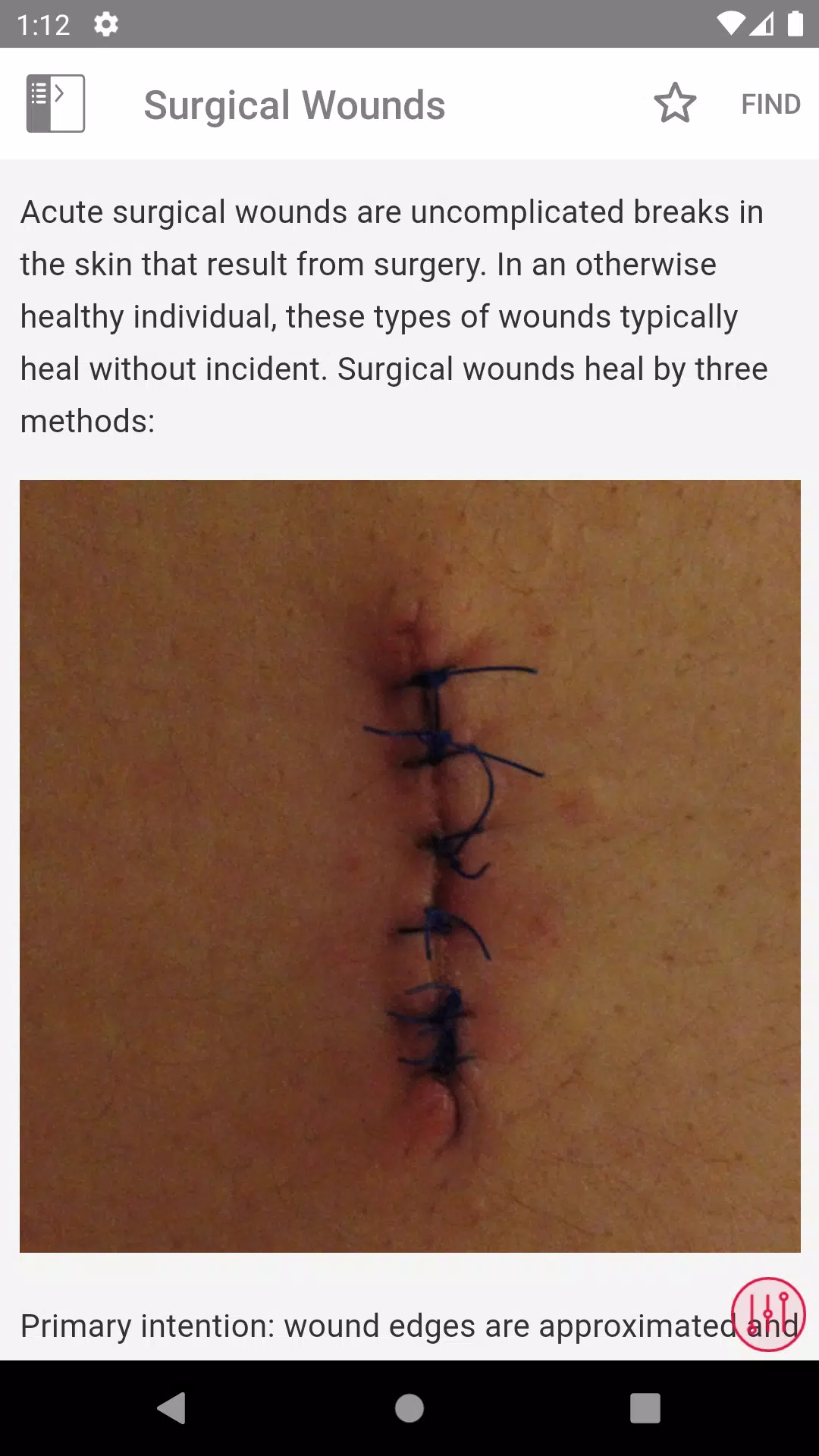 Wound Care MI Visual應用截圖第4張