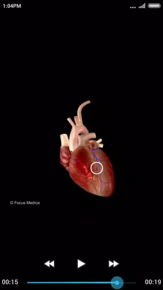 Cardiology-Animated Dictionary應用截圖第3張