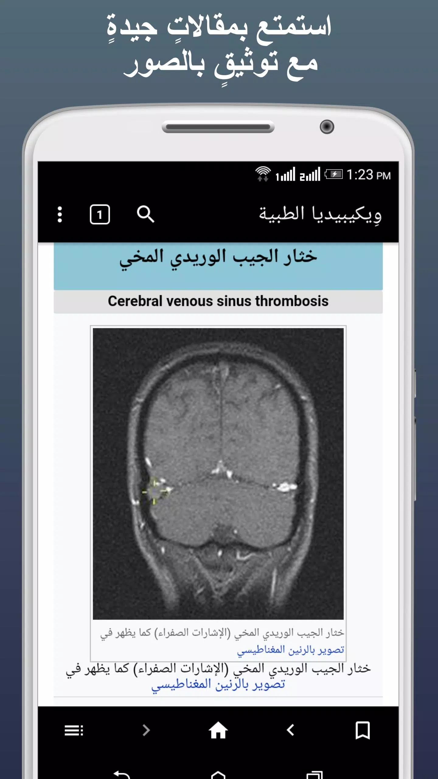 ويكيبيديا الطبية應用截圖第3張