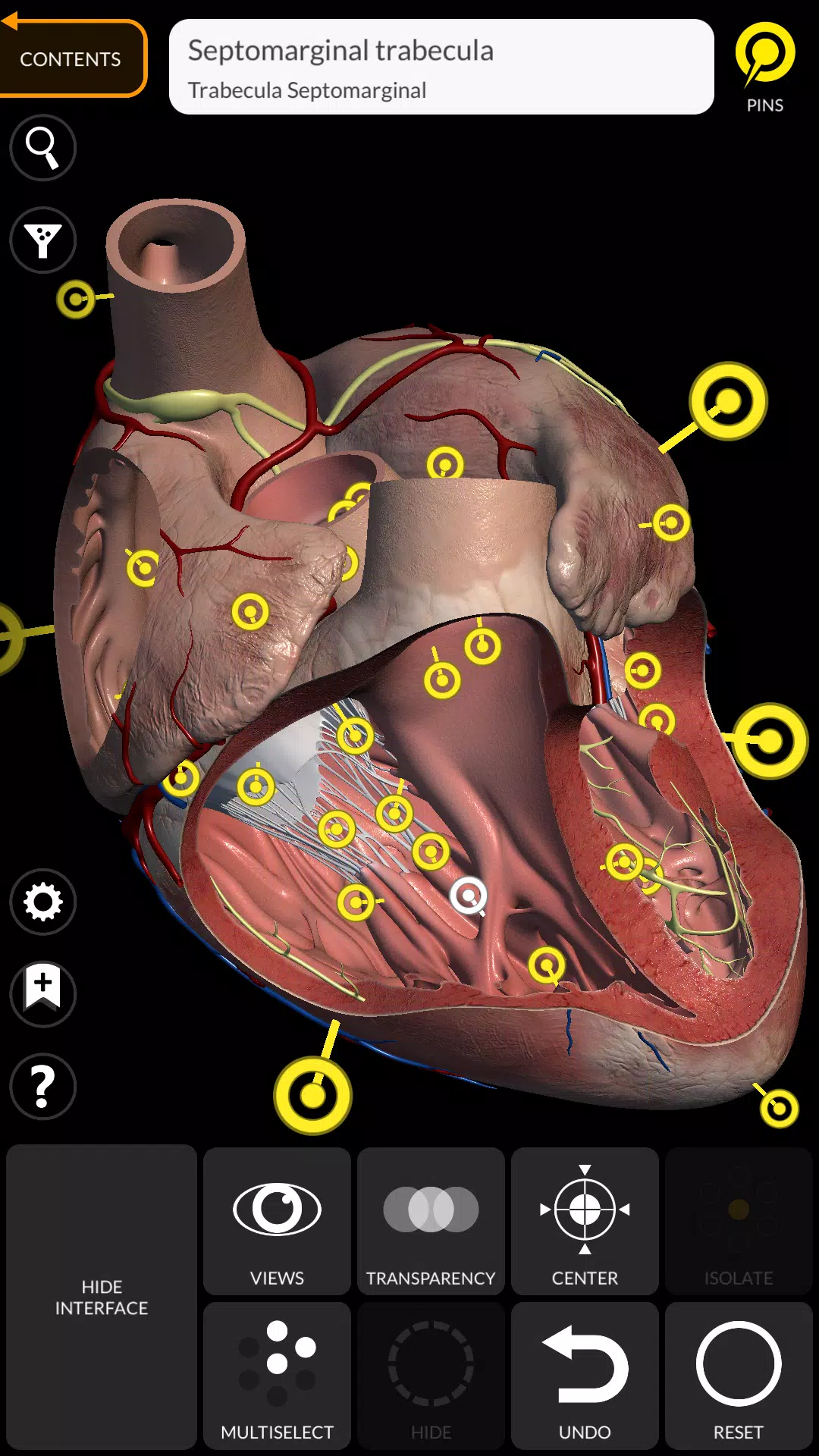 Anatomy 3D Atlas應用截圖第3張