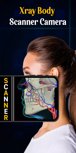X Ray Mobile v.2.0应用截图第2张