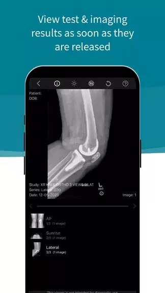 Stanford Health Care MyHealth Capture d’écran 4