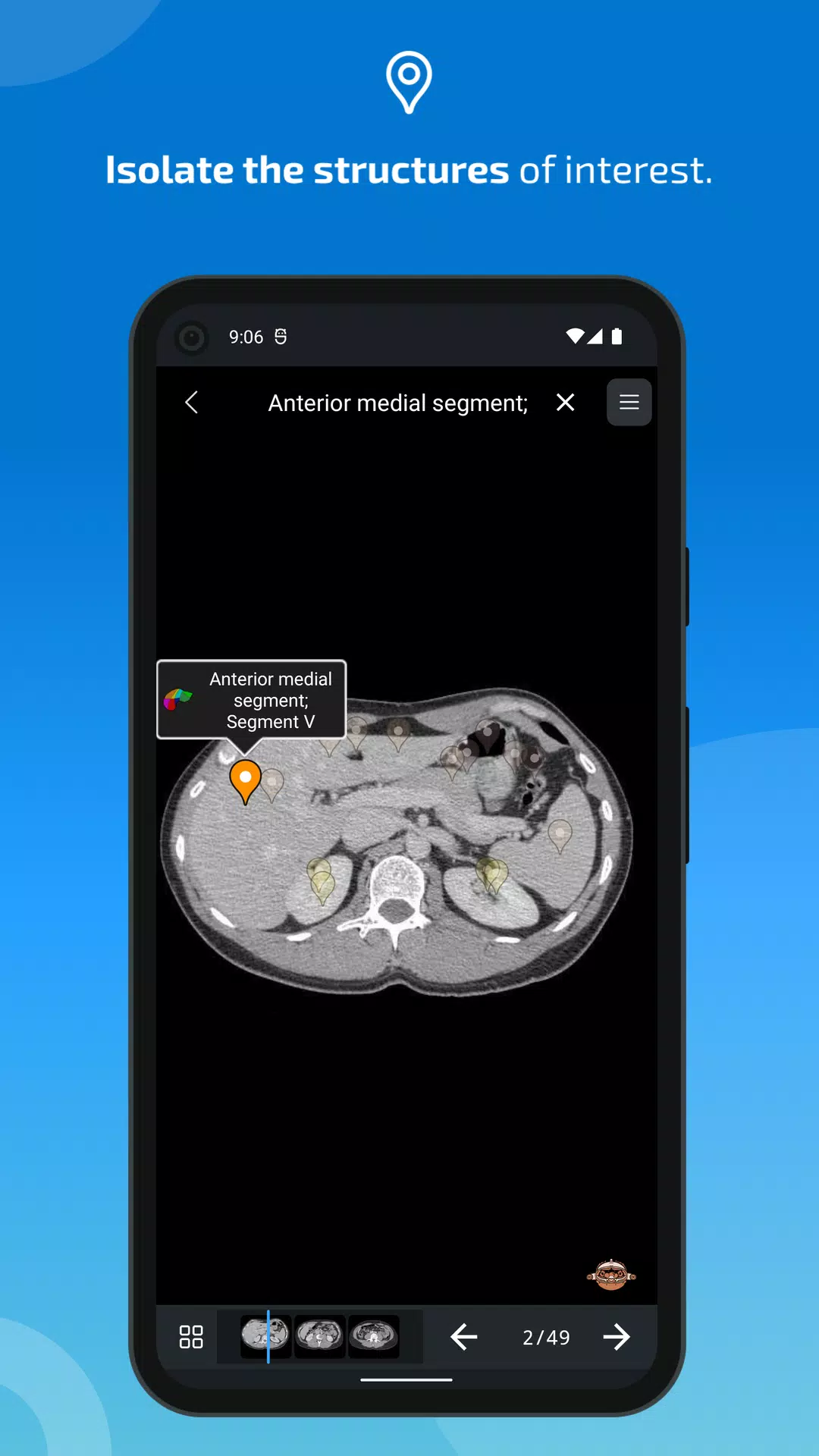 e-Anatomy應用截圖第4張