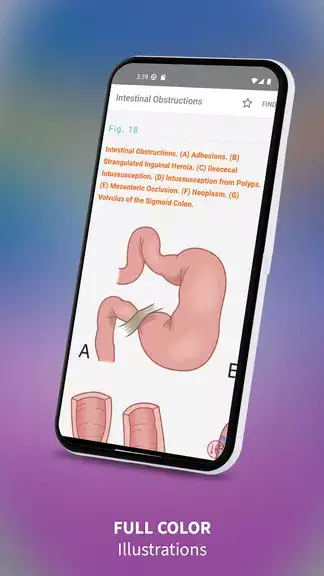 Medical Surgical RN Companion Captura de pantalla 3