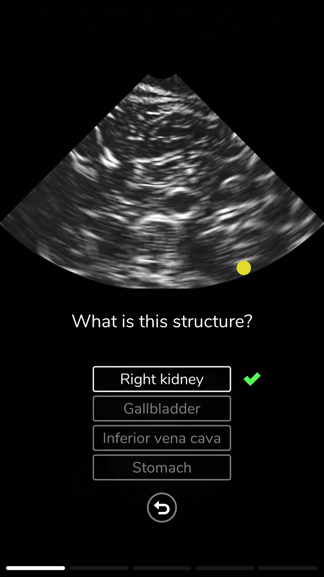 Deepscope Ultrasound Simulator Screenshot 4